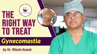 Can Gym or Exercise Cure Gynecomastia? (हिन्दी) | Can gynecomastia go away with gym?