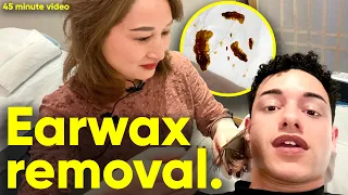 Professional Ear Wax Extraction in China (4K HDR) ASMR | NO TALKING