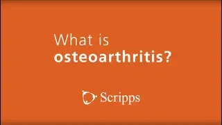 What Is Osteoarthritis? | Ask The Expert