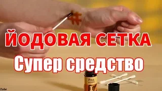 Йодовая сетка  Супер средство  Целебные эффекты