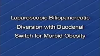 2001 | Laparoscopic Biliopancreatic Diversion with Duodenal Switch