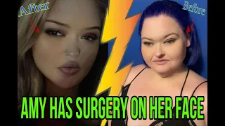 Todays Breaking News! its OVER! SURGERY! But How? Amy Drops Bombshell! 1000-Lb.sisters SE5