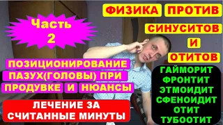 СИНУСИТ И ОТИТЫ. Часть 2: ПОЗИЦИОНИРОВАНИЕ ПАЗУХ.  Лечение методом самопродувки.