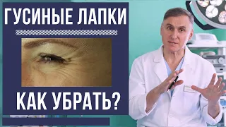 ❗️👍КАК УБРАТЬ ГУСИНЫЕ ЛАПКИ? ПРОЦЕДУРЫ И ПЛАСТИКА