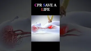 CPR Procedure to save a life #shorts #life