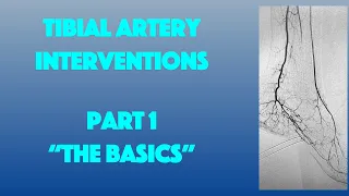 Tibial Artery Interventions Part 1: The Basics