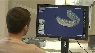 3D-принтеры: технологии в стоматологии