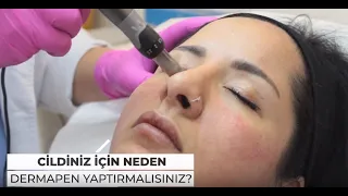 CİLDİNİZ İÇİN NEDEN DERMAPEN YAPTIRMALISINIZ?