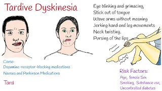 Tardive dyskinesia Causes, Symptoms and Treatment