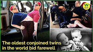 The oldest conjoined twins in the world bid farewell