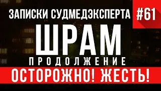 Записки Судмедэксперта 61.2 «Шрам» (Осторожно, ЖЕСТЬ!)