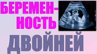 УЗИ ДВОЙНИ | На каком сроке можно определить наличие двойни