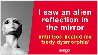 Body dysmorphia - 'I saw an alien in the mirror'