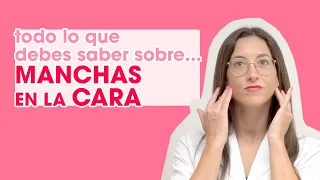 TODO sobre las MANCHAS en la cara: ¿Por qué salen? ¿Tengo que preocuparme?🌟 | Mifarma Farmacia