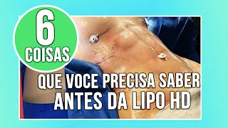 6 COISAS QUE VOCE PRECISA SABER ANTES DE FAZER A LIPO HD - CIRURGIA PLÁSTICA