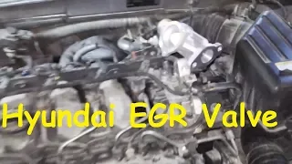 Hyundai Sonata EGR problem / EGR Valve replacement Hyundai /EGR Cleaning