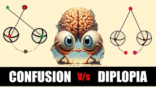 Binocular single Vision | Sensory Adaptations| Confusions, Diplopia, suppression and ARC