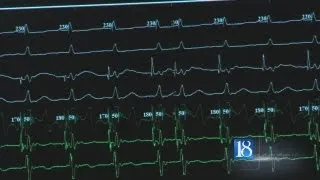 Pacemakers easily solve major problems