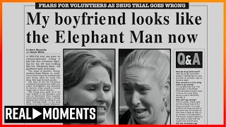 Routine Drug Trials Left Patient As 'The Elephant Man' | Real Moments