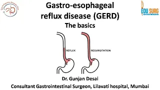 Gastroesophageal reflux disease - reflux versus regurgitation, Montreal consensus, diagnostic tests