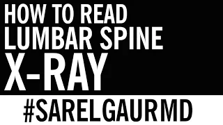 How to Read Lumbar Spine X-ray | Live Interpretation