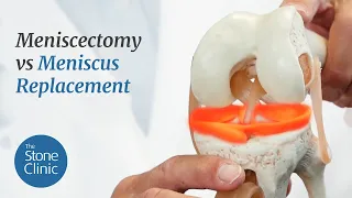 Meniscectomy vs Meniscus Replacement - Meniscus Tear Treatment Options