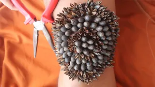 We Help Cleaning Million Big Ticks on Knee Humans With Pliers That Works 100% #371