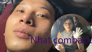 Acne Treatment Huong Da Nang#564 | 2023 | Nhat comback