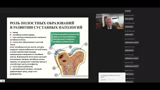 Новые подходы в терапии артроза и артрита при лечении остеопороза иммунотерапией | В. И. Струков