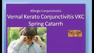 Ophthalmology 088 a Vernal KeratoConjunctivitis VKC Spring Catarrh Allergic Horner Tranta Eye