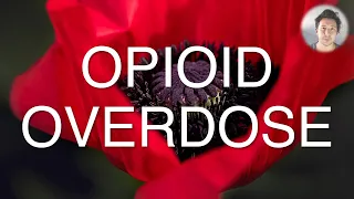 Opioid overdose: Risk assessment and features