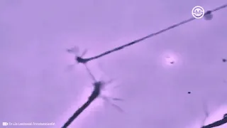 Two neurons literally sensing each other. And trying to connect.