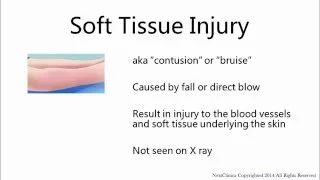 Soft tissue injury