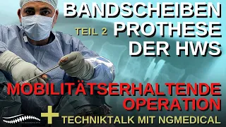 Bandscheibenoperation-Prothese der HWS #bandscheibenvorfall#bandscheibenersatz#ngmedical