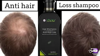 dexe hair shampoo anti hair loss hair treatment that Really Works
