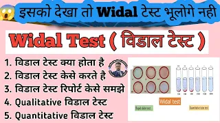 Widal Test Practical in hindi | Qualitative Widal Test | Quantitative Widal Test | Typhoid Test