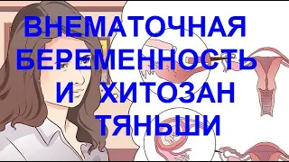 Внематочная беременность и Хитозан Тяньши