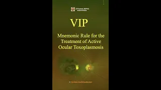 Ocular Toxoplasmosis. VIP,  Mnemonic Rule for the Treatment. #toxoplasmosis #toxoplasmagondii