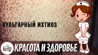 Вульгарный ихтиоз