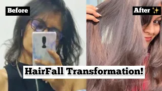 How To Control and Stop Hair Fall , Fast !!Real Transformation ✨