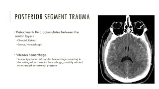 Ocular and Optic Nerve Trauma | Free Radiology CME