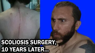 Scoliosis Surgery, 10 Years Later...