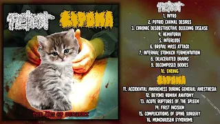 Petiot / Lipoma - The Art of Surgery split CD FULL ALBUM (2023 - Goregrind)