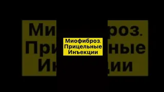 Прицельные инъекции в миофиброз.Лечение фиброза в Одессе
