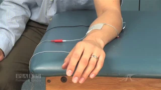 Finger Extension with Thumb Abduction Muscle Stimulation