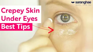 Crepey Skin Under The Eyes: Top Tips To Help