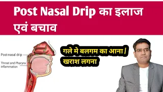 What is Post Nasal Drip? its Cause Symptoms and Treatment Explained (in Hindi)