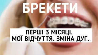 БРЕКЕТИ |  3 МІСЯЦІ | ЗМІНА ДУГ | МОЇ ВІДЧУТТЯ | КОЛЬОРОВІ РЕЗИНКИ