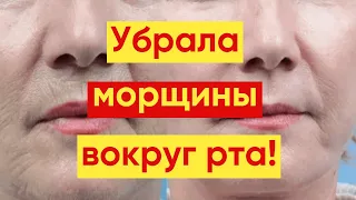 Как 💕УБРАТЬ КИСЕТНЫЕ МОРЩИНЫ Вокруг Рта – 3 СПОСОБА!