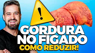 Como diminuir a gordura no fígado | Dr RENATO SILVEIRA